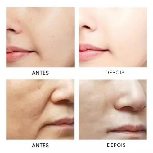 Sérum Ginseng® Colagénio Antienvelhecimento e Ácido Hialurónico - 50% DESCONTO + ENVIO GRÁTIS - [PROMOÇÃO DISPONÍVEL APENAS HOJE]