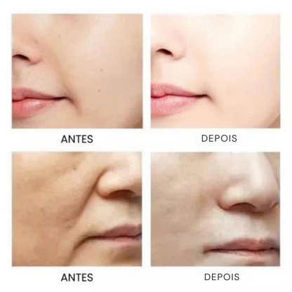 Sérum Ginseng® Colagénio Antienvelhecimento e Ácido Hialurónico - 50% DESCONTO + ENVIO GRÁTIS - [PROMOÇÃO DISPONÍVEL APENAS HOJE]