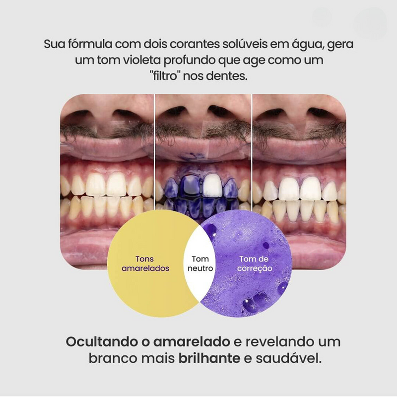 Sérum V34™ Clareador Dentário - [PROMOÇÃO DISPONÍVEL SÓ HOJE]