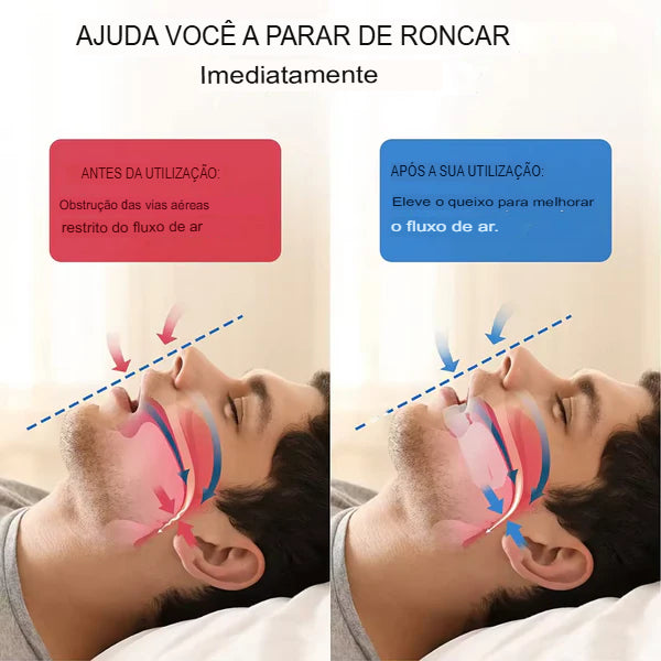 BeQuiet™ - Boqueira Anti-Ressonar -  [PROMOÇÃO DISPONÍVEL SÓ HOJE]